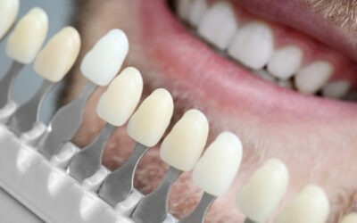 Porcelain Veneers