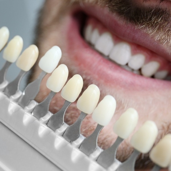 Porcelain Veneers