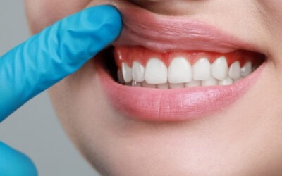 Gum Grafts