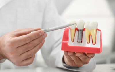 Implant Dentistry and Restoration