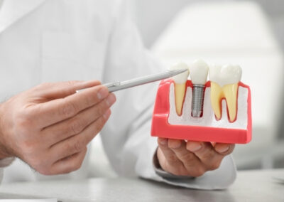 Implant Dentistry and Restoration