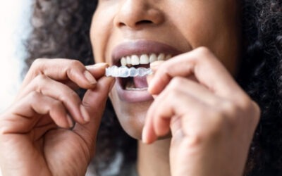 Invisalign