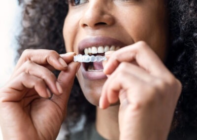 Invisalign
