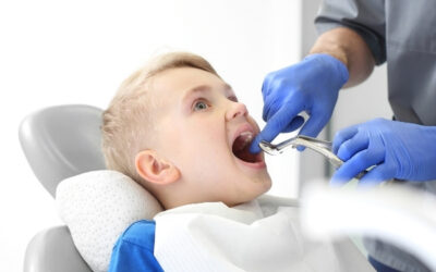 Tooth Extractions