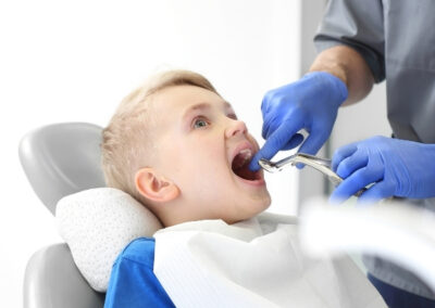 Tooth Extractions