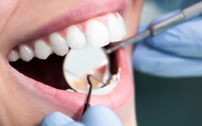 Full Mouth Rehabilitation