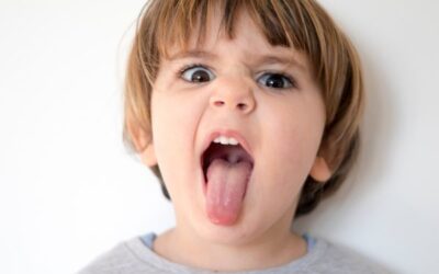 Tongue Tie Release