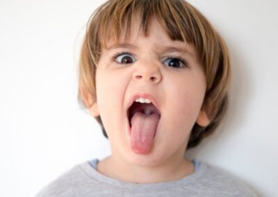Tongue Tie Release